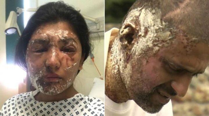 Ketika Cairan Asam Dijadikan Sebagai Senjata