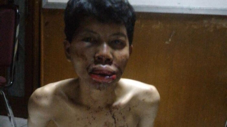 Maling Handphone di Tanjung Priok Nyaris Tewas Diamuk Warga