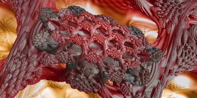 Begini Caranya Deteksi Kanker Lewat Tes Darah!