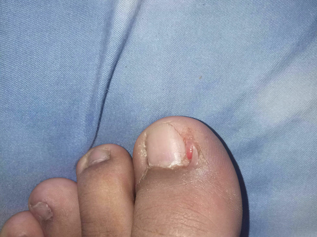 Help Gan!! Cantengan Ane Harus Di Gimanain Ni?
