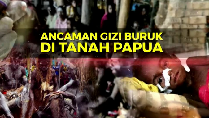 Miris! Gizi Buruk Di (Papua) Seharusnya Tidak Terjadi, Ini Faktanya.