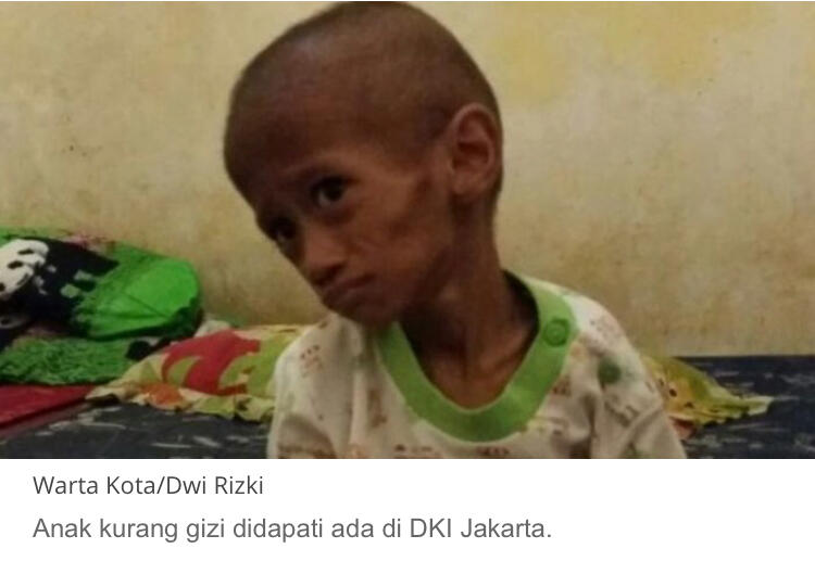 194 Balita di Jakarta Utara Masuk Kategori Gizi Kurus Sekali