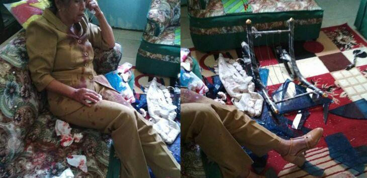 Kepala Sekolah di Sulut Dilempar Meja Kaca Hingga Luka Parah