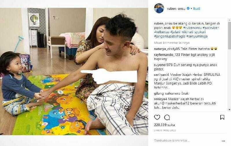 Gak Cuma Artis Indonesia, Ada Juga Artis Luar Negeri Yang Kerokan Kalau Lagi Sakit