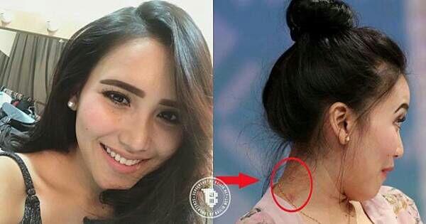 Gak Cuma Artis Indonesia, Ada Juga Artis Luar Negeri Yang Kerokan Kalau Lagi Sakit
