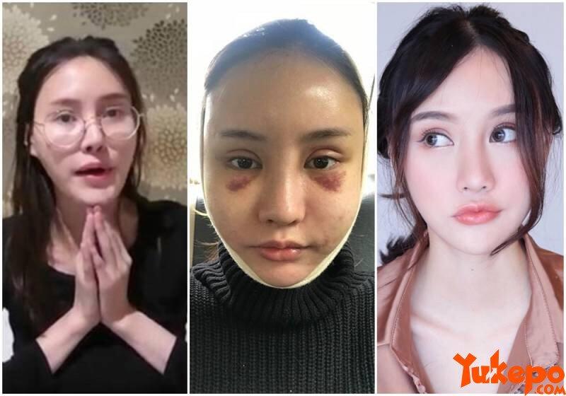 Nggak Langsung Cantik, Foto Wanita Setelah Operasi Plastik Ini Bikin Merinding Disko