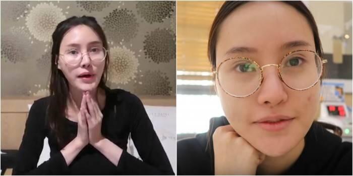 Nggak Langsung Cantik, Foto Wanita Setelah Operasi Plastik Ini Bikin Merinding Disko