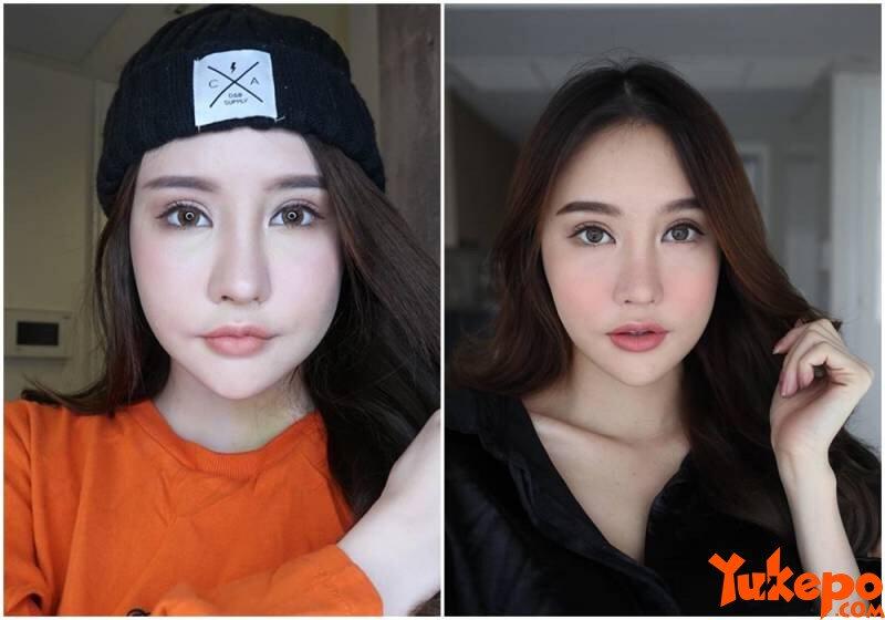 Nggak Langsung Cantik, Foto Wanita Setelah Operasi Plastik Ini Bikin Merinding Disko