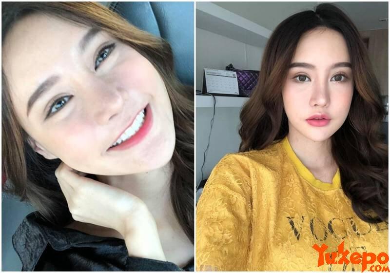 Nggak Langsung Cantik, Foto Wanita Setelah Operasi Plastik Ini Bikin Merinding Disko