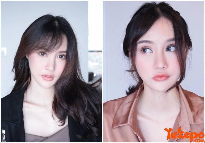 Nggak Langsung Cantik, Foto Wanita Setelah Operasi Plastik Ini Bikin Merinding Disko