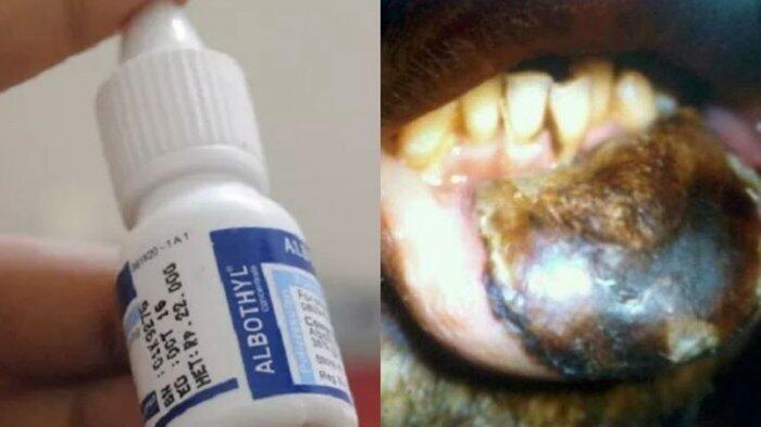 Bibir Anda Sariawan? Jangan Lagi Pakai Abothyl, BPOM Sarankan Gunakan Obat Ini
