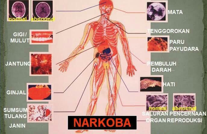 Saat Anak Raja dan Ratu Dangdut Sama - Sama Tercyduk Narkoba