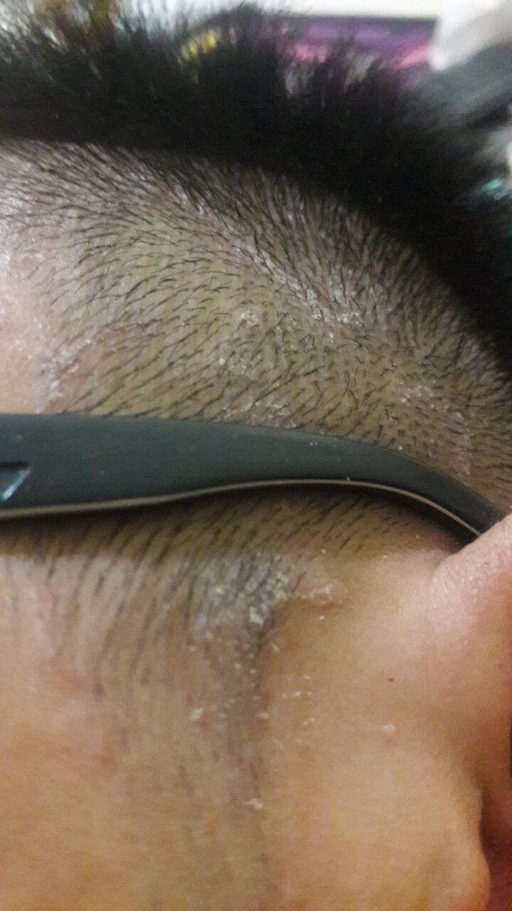 Ada apa dengan kulit rambut saya???