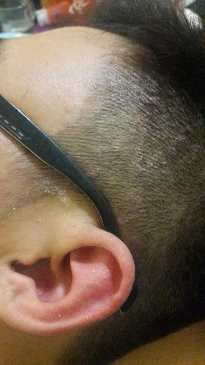 Ada apa dengan kulit rambut saya???