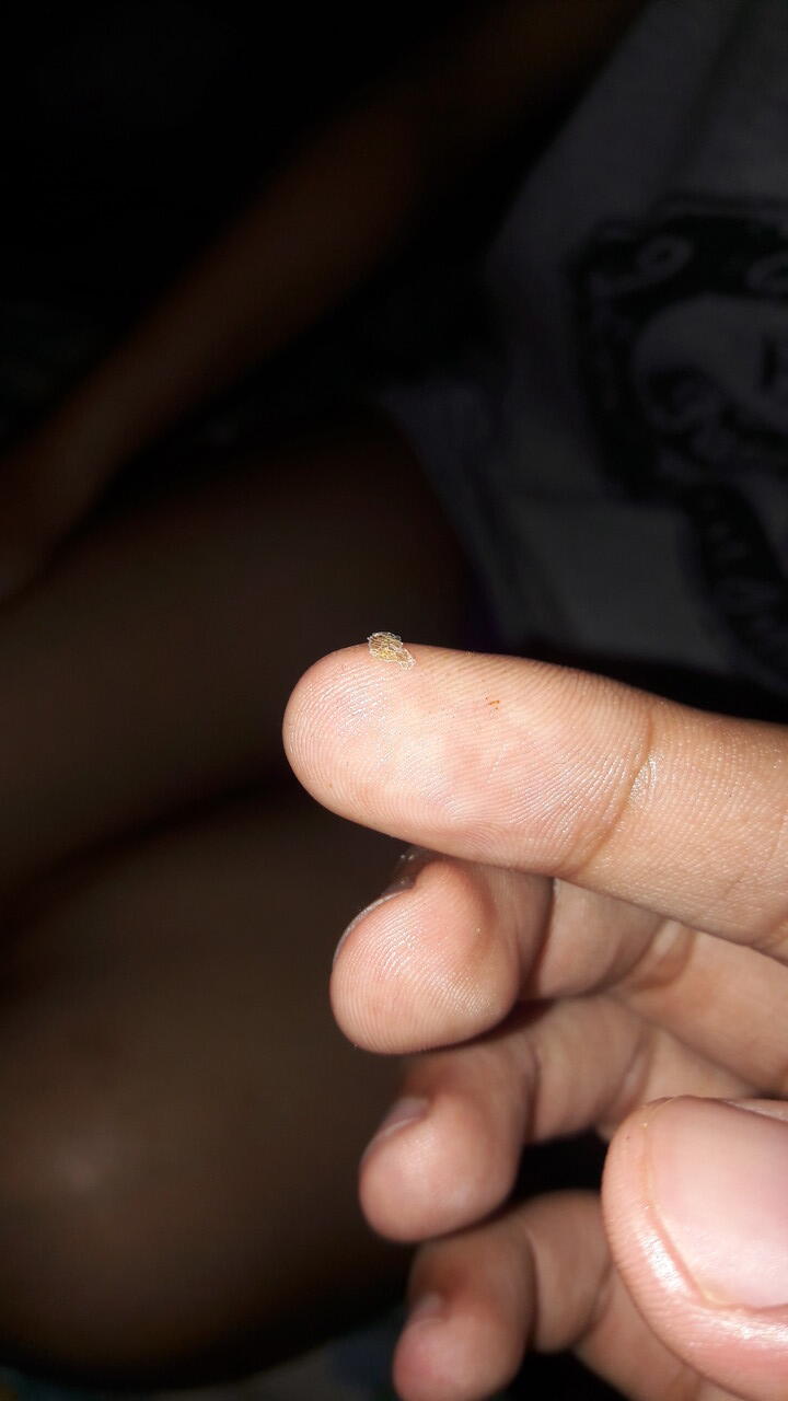 Ada apa dengan kulit rambut saya???