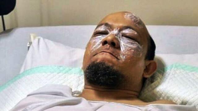 Kasus Novel Baswedan Setelah 10 Bulan: Tetap Dipandang Sebelah Mata