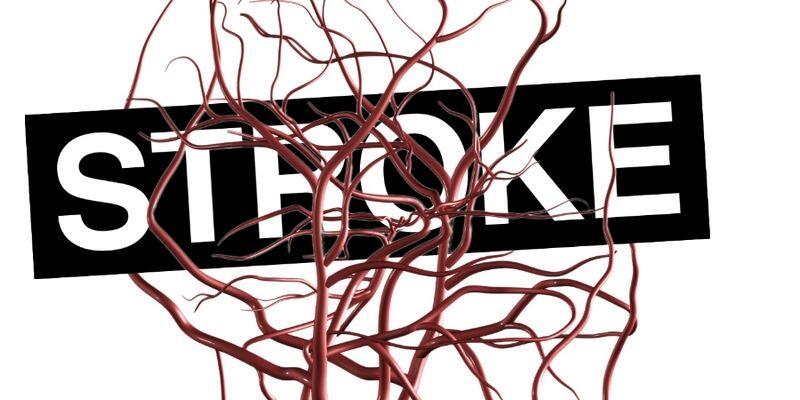 Yuk Cegah dan Kurangi Risiko Terkena Stroke