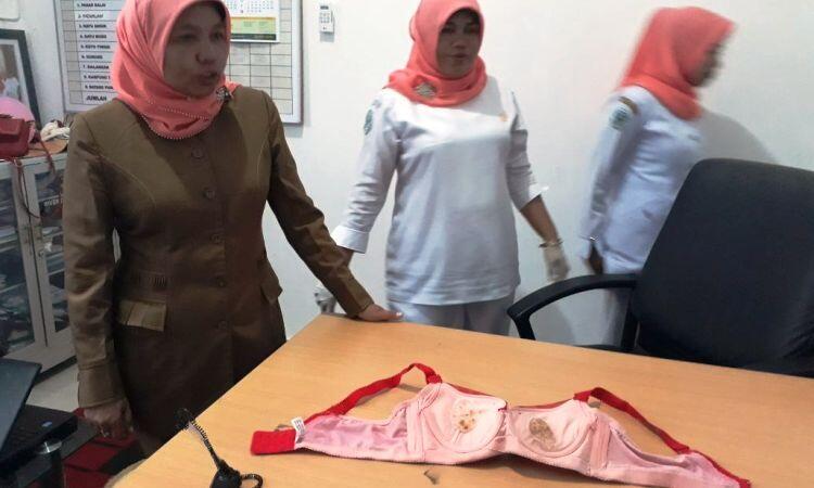 Gadis Padang Pariaman Derita Sakit dan Gatal Usai Gunakan Bra Bekas Impor
