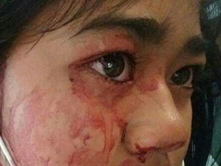 Fenomena Menangis Darah Hoax??