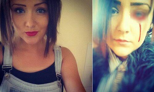 Fenomena Menangis Darah Hoax??