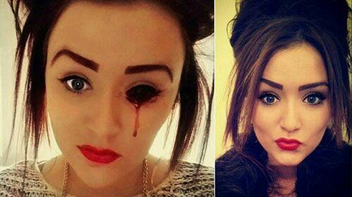 Fenomena Menangis Darah Hoax??