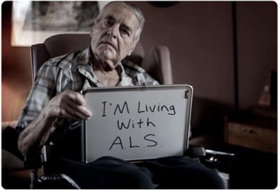 ALS, Bukan Bus! Inilah Penyakit Yang Diderita Stephen Hawking Sepanjang Hidupnya