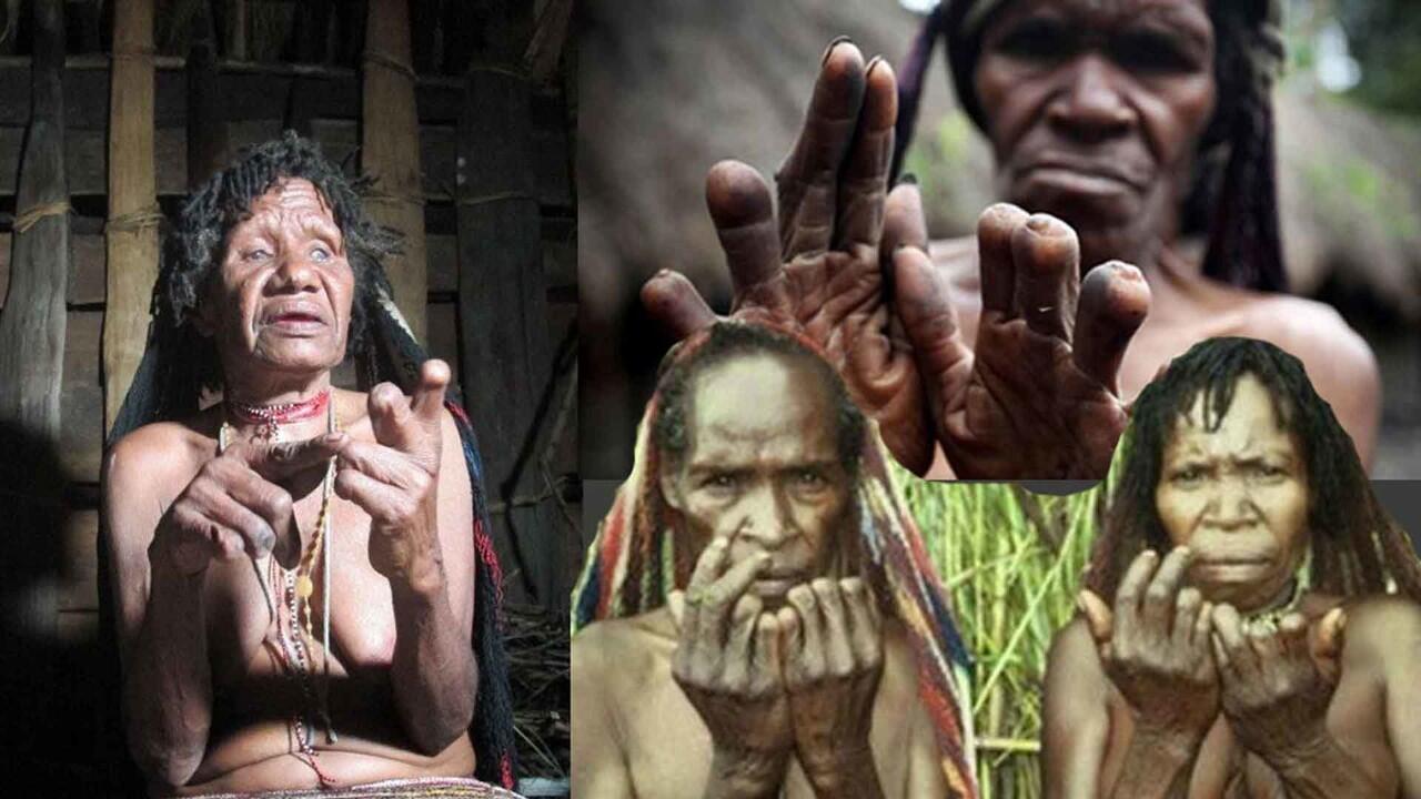 Tradisi Potong Jari Suku Dani, Bukti Kesetiaan Terhadap Keluarga