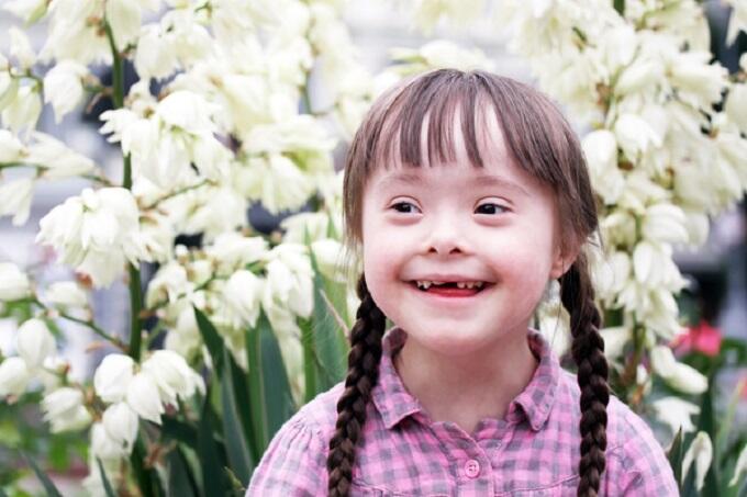 21 Maret, Hari Down Syndrome Sedunia
