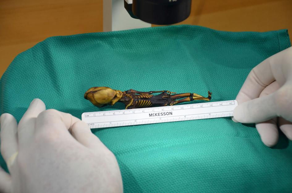 Ata, Mumi 16 cm Ternyata Bukan Alien. Tapi Kenyataannya Justru Lebih Ajaib Dari Itu.