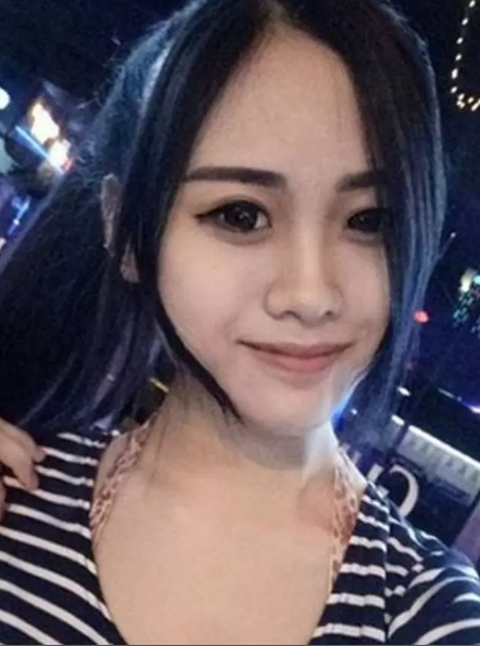 mengejutkan ! gadis cantik ini menjadi seperti alien setelah oplari plastik