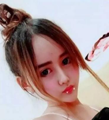 mengejutkan ! gadis cantik ini menjadi seperti alien setelah oplari plastik