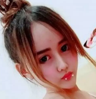 mengejutkan ! gadis cantik ini menjadi seperti alien setelah oplari plastik