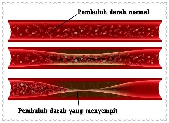 Ngilu! 10 Bahaya Kamu Dalam Suhu Dingin Ekstrem
