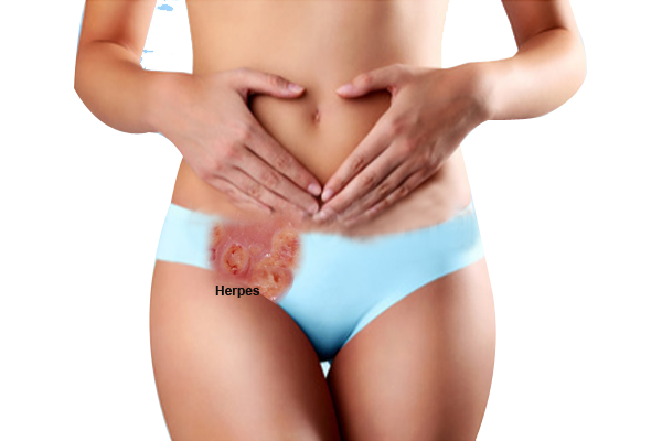 Dear Sista, Kenali Penyakit yang Mengincar Vagina
