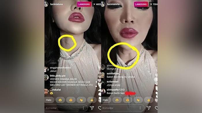 Lucinta Luna Live di Instagram, Netizen Justru Fokus ke Tenggorokannya