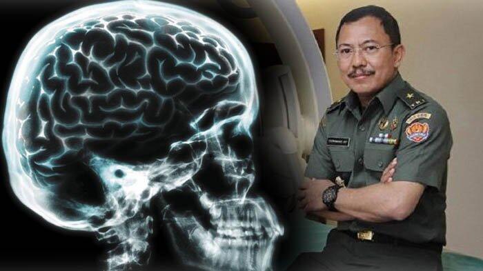 Ketua IDI Kaget Surat Pemberhentian Sementara Dokter Terawan Jadi Konsumsi Publik