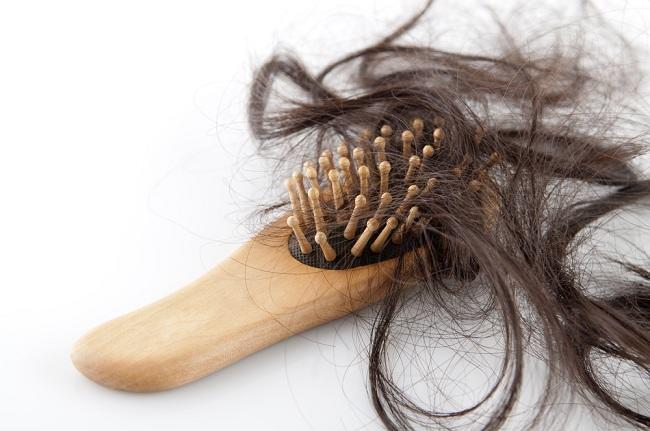 Berbagai Sebab Rambut Mudah Rontok