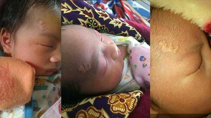 Viral, Bayi di Kalimantan Selatan ini Miliki Lafal Allah di Dahinya