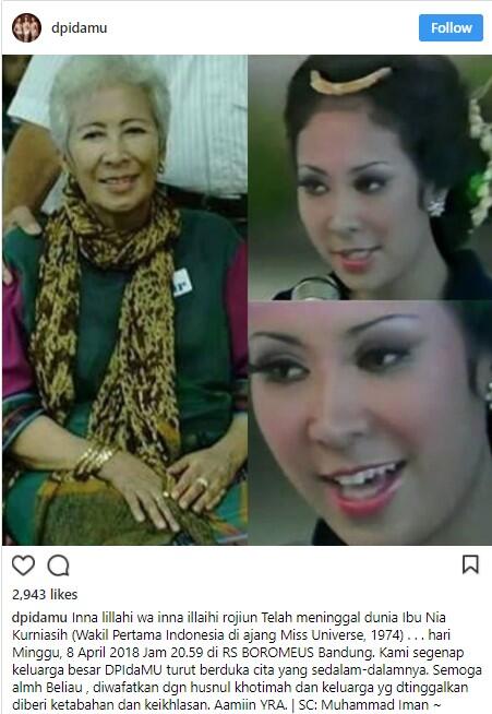 Wakil Pertama Indonesia di Ajang Miss Universe Tutup Usia