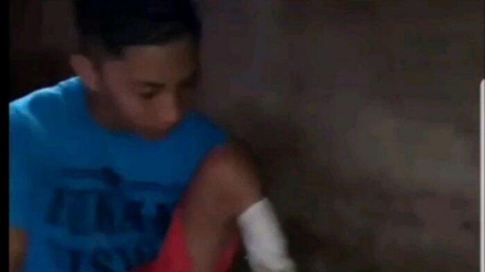 Saat Pelajar SD Minta Kaki Palsu