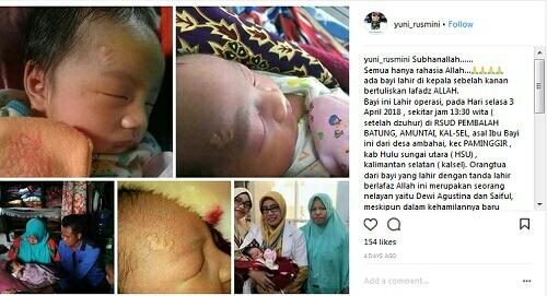 Ada Lafadz Allah di Dahi, Foto Bayi Ini Viral di Medsos