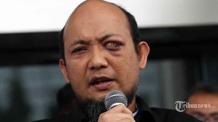 Setahun Kasusnya Belum Terungkap, Novel Baswedan Mulai Kecewa kepada Polisi