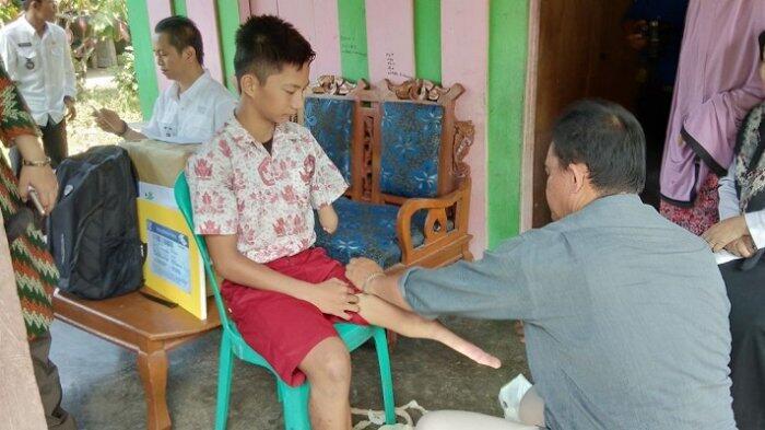 Wajah Amin Berbinar Setelah Dapat Kaki Palsu