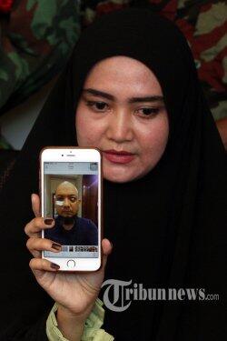 Ini Harapan Istri Novel Baswedan Pasca Setahun Teror Air Keras