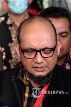Setahun Berlalu Kasusnya Belum Juga Diungkap, Novel Baswedan: Saya Kecewa Sekali