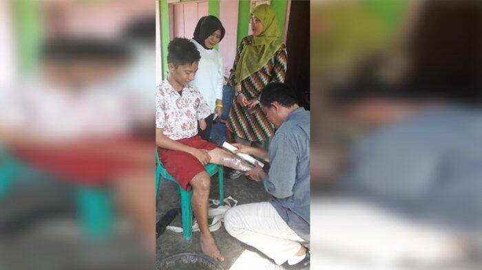 Dapat Kaki Palsu Dari Mensos, Amin Syam: Terimakasih Banyak Pak