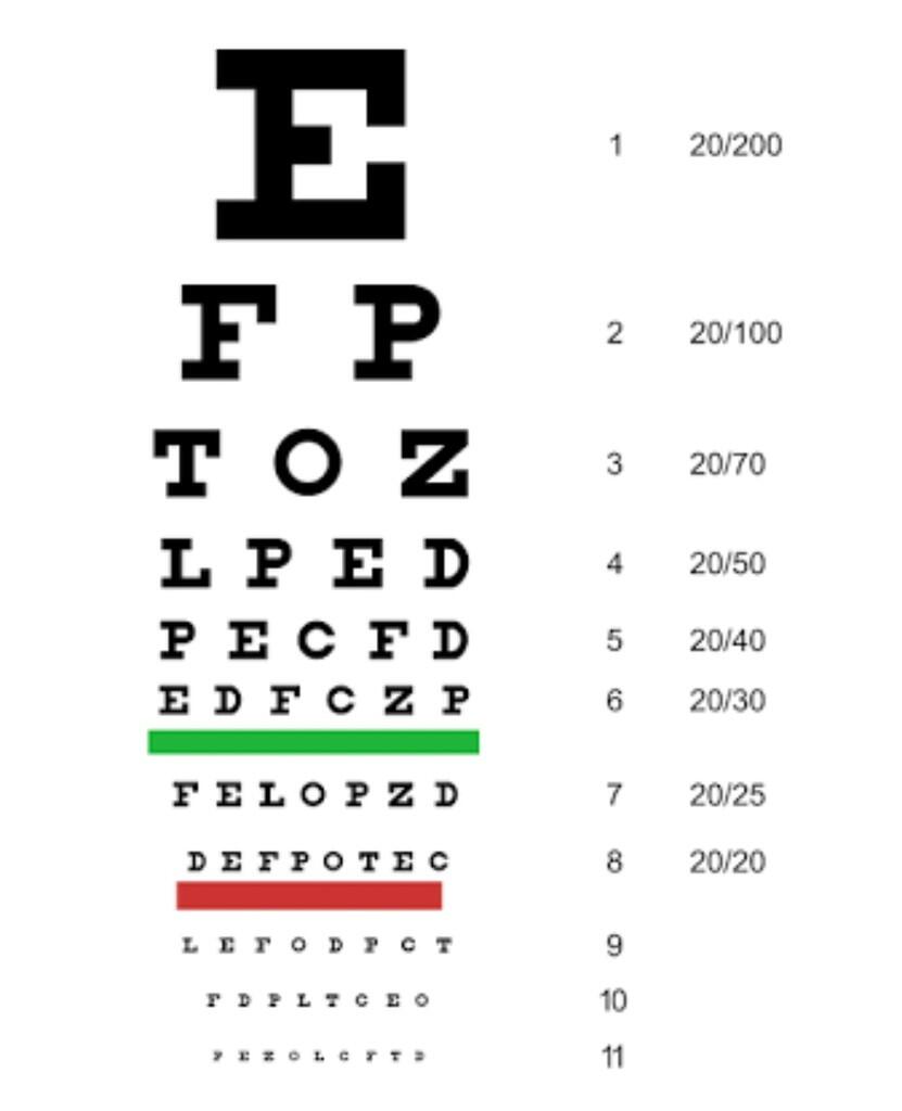 Refraksi Optisi,apakah itu?