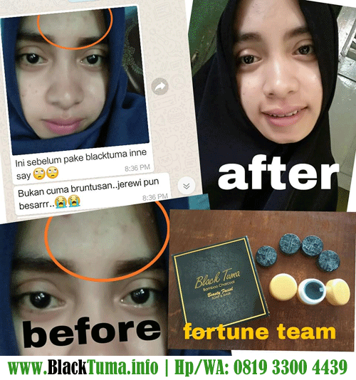 Bisnis Black Tuma - Modal 75ribu - Produk Laris diPasaran sudah BPOM
