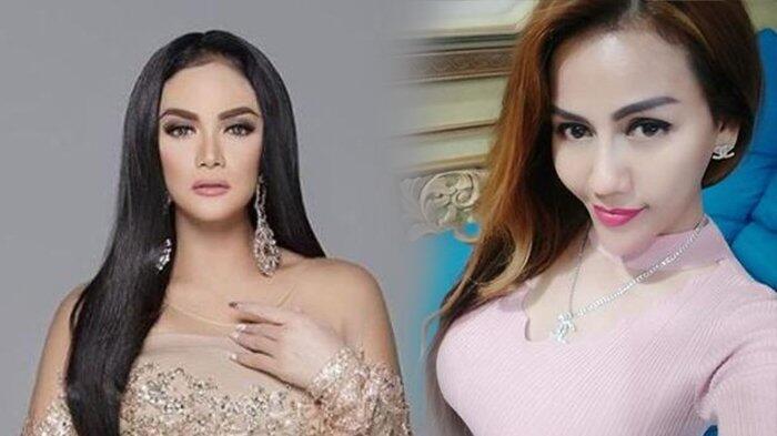 4 Seleb Ini Blak-blakan Pernah Jalani Operasi Plastik, Before & After-nya Beda Jauh!