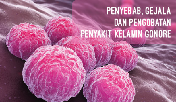 Sering Jajan Diluar? Awas 4 Penyakit Kelamin Ini Siap Menginfeksi Kamu